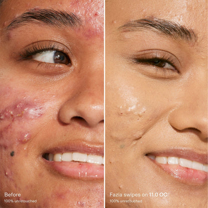 Swipe Serum Concealer®