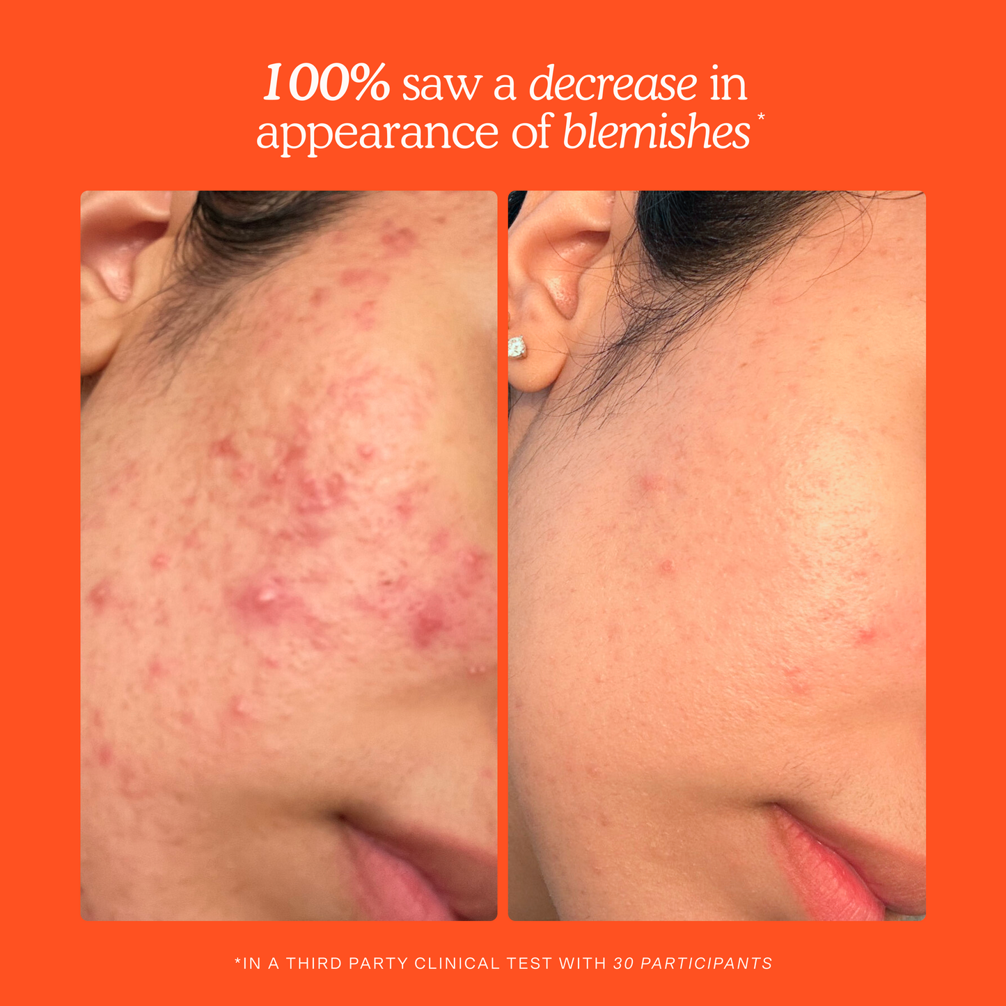 SOS Daily Rescue Spray Duo