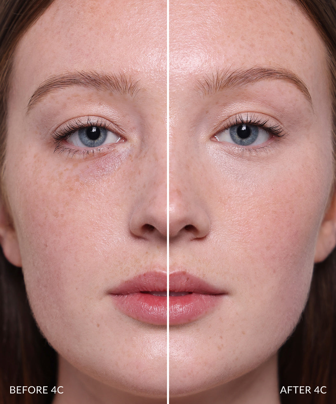 Concealer