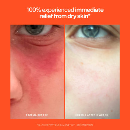 SOS Rescue Serum