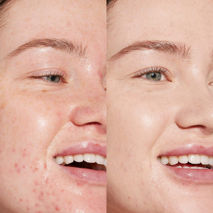 Swipe Serum Concealer®